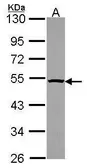 Anti-PSMC4 antibody used in Western Blot (WB). GTX114675