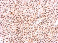 Anti-PSMC6 antibody used in IHC (Paraffin sections) (IHC-P). GTX114677
