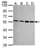 Anti-PSMD4 antibody [N1C2] used in Western Blot (WB). GTX114678