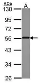 Anti-PSMD4 antibody [N2C3] used in Western Blot (WB). GTX114679