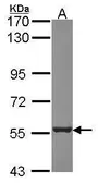 Anti-PSMD5 antibody [N1C1] used in Western Blot (WB). GTX114681