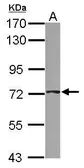 Anti-ABCD4 antibody [N1C1] used in Western Blot (WB). GTX114689