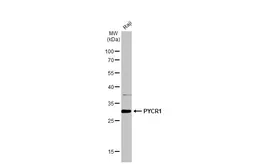 Anti-PYCR1 antibody used in Western Blot (WB). GTX114693