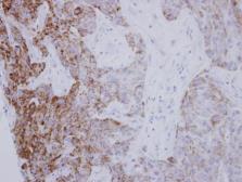 Anti-PYCR1 antibody used in IHC (Paraffin sections) (IHC-P). GTX114693