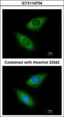 Anti-Arginyl tRNA synthetase antibody [N2C2], Internal used in Immunocytochemistry/ Immunofluorescence (ICC/IF). GTX114704