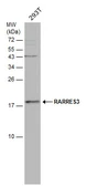 Anti-RARRES3 antibody [N1C3] used in Western Blot (WB). GTX114706