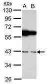 Anti-RBMS1 antibody [N2C3] used in Western Blot (WB). GTX114710
