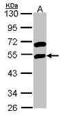 Anti-RBMS1 antibody [N2C3] used in Western Blot (WB). GTX114710