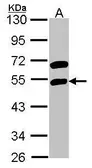 Anti-RBMS1 antibody [N2C3] used in Western Blot (WB). GTX114710