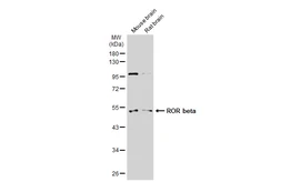 Anti-ROR beta antibody used in Western Blot (WB). GTX114722