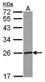 Anti-RPE antibody [N2C3] used in Western Blot (WB). GTX114724