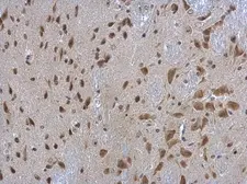 Anti-RPL3 antibody [N3C3] used in IHC (Paraffin sections) (IHC-P). GTX114725
