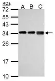 Anti-RPL7A antibody used in Western Blot (WB). GTX114727