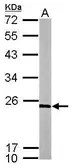 Anti-RPL9 antibody used in Western Blot (WB). GTX114728