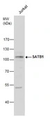 Anti-SATB1 antibody used in Western Blot (WB). GTX114737