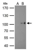 Anti-SATB1 antibody [C2C3], C-term used in Immunoprecipitation (IP). GTX114738