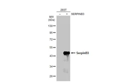 Anti-SerpinB3 antibody [N2C3] used in Western Blot (WB). GTX114739