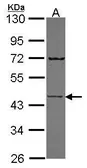 Anti-Semenogelin I antibody [N2C2], Internal used in Western Blot (WB). GTX114744