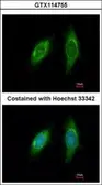 Anti-SGTA antibody [N2C3] used in Immunocytochemistry/ Immunofluorescence (ICC/IF). GTX114755