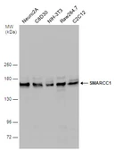 Anti-SMARCC1 antibody [C2C3], C-term used in Western Blot (WB). GTX114777