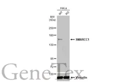 Anti-SMARCC1 antibody [C2C3], C-term used in Western Blot (WB). GTX114777