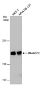 Anti-SMARCC2 / BAF170 antibody used in Western Blot (WB). GTX114778