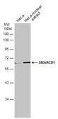 Anti-SMARCD1 antibody [N2C1], Internal used in Western Blot (WB). GTX114780