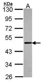 Anti-Syntrophin alpha 1 antibody [N3C3] used in Western Blot (WB). GTX114786