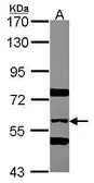 Anti-SNX2 antibody used in Western Blot (WB). GTX114788