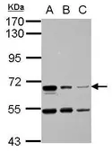 Anti-HAI-1 antibody used in Western Blot (WB). GTX114793
