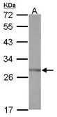 Anti-SSX5 antibody used in Western Blot (WB). GTX114800