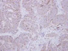 Anti-STXBP2 antibody used in IHC (Paraffin sections) (IHC-P). GTX114810