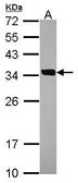 Anti-SULT2A1 antibody [N1C3] used in Western Blot (WB). GTX114814