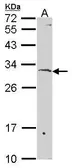 Anti-SURF1 antibody [N2C3] used in Western Blot (WB). GTX114816
