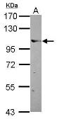 Anti-Elongin A antibody [C2C3], C-term used in Western Blot (WB). GTX114828
