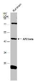 Anti-AP2 beta antibody used in Western Blot (WB). GTX114832