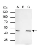 Anti-AP2 beta antibody used in Immunoprecipitation (IP). GTX114832