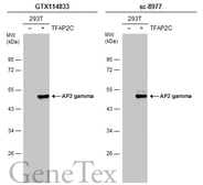 Anti-AP2 gamma antibody used in Western Blot (WB). GTX114833