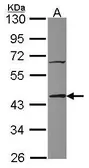 Anti-TIAL1 antibody [N2C2], Internal used in Western Blot (WB). GTX114838