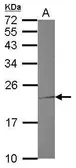 Anti-TNNI1 antibody [N1C3] used in Western Blot (WB). GTX114848