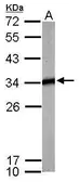 Anti-Tropomyosin 4 antibody used in Western Blot (WB). GTX114851