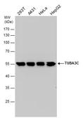 Anti-TUBA3C antibody used in Western Blot (WB). GTX114862