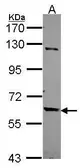 Anti-TULP2 antibody [C1C3] used in Western Blot (WB). GTX114865