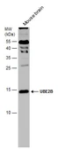 Anti-UBE2B antibody used in Western Blot (WB). GTX114867