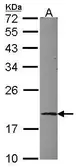 Anti-UBE2G1 antibody used in Western Blot (WB). GTX114869