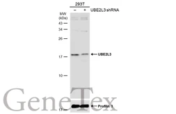 Anti-UBE2L3 antibody [N1C3] used in Western Blot (WB). GTX114870