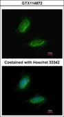 Anti-UMPS antibody used in Immunocytochemistry/ Immunofluorescence (ICC/IF). GTX114872