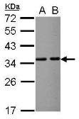Anti-VDAC2 antibody [N1C2] used in Western Blot (WB). GTX114876