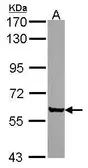 Anti-Coronin 2A antibody [C1C3] used in Western Blot (WB). GTX114880