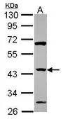 Anti-ZNF2 antibody [N1N3] used in Western Blot (WB). GTX114885